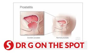 EP181 Prostatitis dampening sexual performance  PUTTING DR G ON THE SPOT [upl. by Nemrak717]