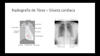 Corazón Pt 1 Configuración externa corazón [upl. by Steffi]