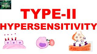 Type II Hypersensitivity  Antibody mediated Hypersensitivity  Mechanism  Examples [upl. by Eusoj158]