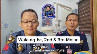 Wala ng 1st 2nd at 3rd Molar [upl. by Reseta]