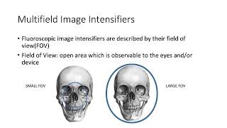 Multifield Image Intensifiers and Magnification [upl. by Nishom448]