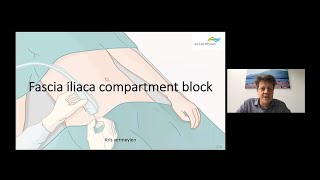 Suprainguinal Fascia Iliaca Block for Perioperative Analgesia after Total Hip Arthroplasty [upl. by Anelej]