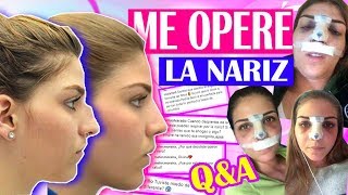 ME OPERÉ LA NARIZ CON DR FROILAN PAEZ  Storytime  RESPONDO SUS PREGUNTAS  Magic Armarium [upl. by Simonne298]