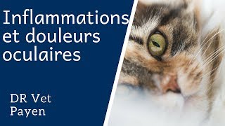 Inflammations et douleurs oculaires [upl. by Teresina]