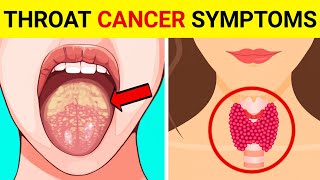 Throat Cancer  Signs And Symptoms of Throat Cancer   Throat Cancer Symptoms [upl. by Adnorahs742]