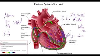 Fibrilación Ventricular Explicación Detallada [upl. by Boaten712]