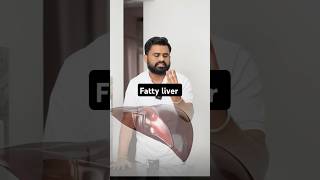 Fatty liver घर के खाने की ताकत को पहचानो drrobin health food ayurved doctor facts remedy [upl. by Ayyn]