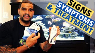 Internal Parasites Fish Medication  Treatment with Seachem Metroplex [upl. by Amik139]