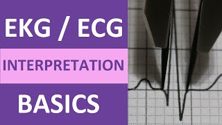 EKGECG Interpretation Basics Nursing NCLEX  QRS Complex P Wave T Wave PR Interval [upl. by Pardoes]