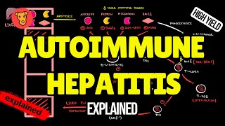 AUTOIMMUNE HEPATITIS Pathogenesis Clinical symptoms Diagnostic criteria Treatment [upl. by Adelpho]