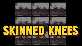 Fair Call  Skinned Knees Official Music Video [upl. by Solley544]