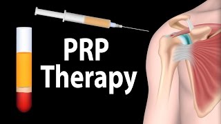 PRP Therapy Animation [upl. by Golightly470]