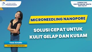 MICRONEEDLING NANOPORE SOLUSI CEPAT UNTUK KULIT GELAP DAN KUSAM [upl. by Schrader276]