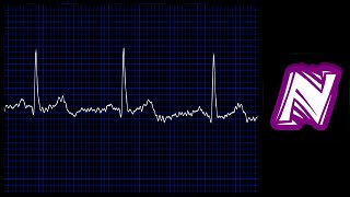 Sonido de monitor cardiaco  Heart monitor sound effect  Ekg sound  Sonido electrocardiograma [upl. by Jablon388]