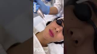 Pico Laser Treatment in Dubai – Skin Rejuvenation Pigmentation amp Acne Scar Removal [upl. by Lombard]