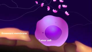 Introduction to Cancer Biology Part 3 Tissue Invasion and Metastasis [upl. by Nwatna]