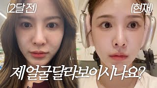 SUB Vlog  얼굴이 달라진 이유  쥬베룩 볼륨 후기  콜라겐주사👼🏻  쇼핑 하울🛍️  미드 보며 영어공부 하는 법  시티브리즈 모델👗 테라스에서 가을 만끽🍁 [upl. by Frech97]