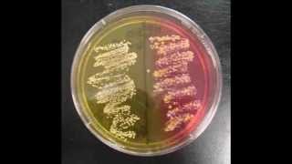 Mannitol Salt Agar MSA Bacterial Growth Medium Microbiology Lab Tutorial [upl. by Collier]