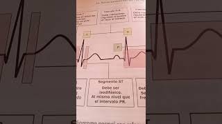 Electrocardiograma parte 5 medicina [upl. by Aleka]