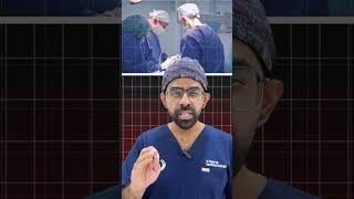 Varicocele Treatment Without Surgery by Varicocele Embolization  Varicocele Treatment in Delhi [upl. by Nylzzaj]