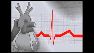 01 INTRODUCTION  ELECTROCARDIOGRAPHY ECG ONLINE COURSE [upl. by Claudia]