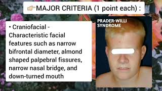 Prader Willi Syndrome Genetics Symptoms and Diagnosis [upl. by Weinrich]