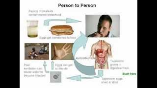 Cysticercosis and Neurocysticercosis Whos At Risk [upl. by Arriat]