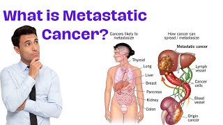 Understanding Metastasis  What is Metastatic Cancer [upl. by Lady]