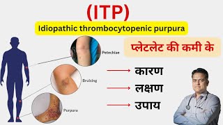 ITP बीमारी क्या है । प्लेटलेट की कम रहने का कारण । Thrombocytopenia symptoms and treatment । [upl. by Nivled]