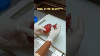 Total thyroidectomy specimen 😳 [upl. by Archangel392]