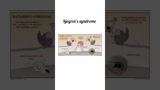 Sjogrens Syndrome kattrucate medicalreels sjogren syndrome immune drymouth jointpain short [upl. by Bogart]