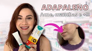 ADAPALENO ACABA COM A ACNE CLAREIA MANCHAS E MUITO MAIS [upl. by Nedry]