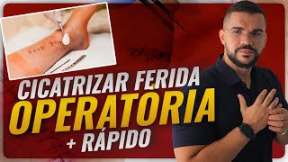 COMO CICATRIZAR UMA FERIDA OPERATÓRIA MAIS RÁPIDO [upl. by Rabbaj]