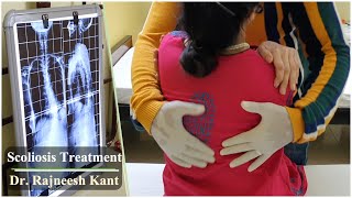 Scoliosis Treatment  Non Surgical Management Of Scoliosis  Dr Rajneesh Kant [upl. by Bray857]