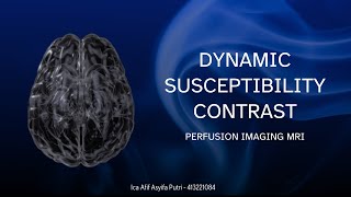 Resume Dynamic Susceptibility Contrast  MRI Perfusion [upl. by Ylrebmi]