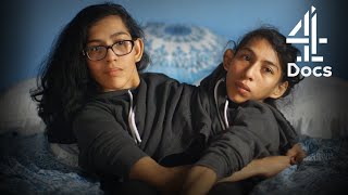 Conjoined Twins on Heartbreaking Difficulty of Being Immigrants in America  Two Sisters One Body [upl. by Etheline]