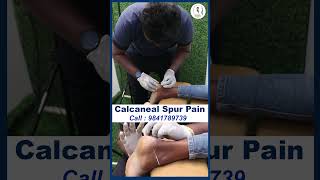 Calcaneal Spur Pain treatment  DrVijay Non Surgical  Chiropractic Treatment [upl. by Newfeld]