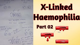 Genetics of X Linked Haemophilia disorder l Crossing of haemophilic couples lFor ClassXII and Mdcat [upl. by Ecneralc362]