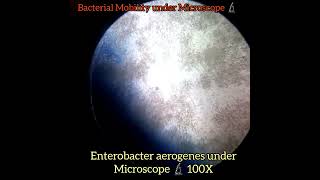 Enterobacter aerogenes under Microscope 🔬100X4501000X Bacteria  Klebsiella aerogenes [upl. by Lledraw]