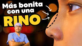 Una Rinoplastia Muy Sutil La Embelleció🌹 Rino Estructurada ✅ Dr Percy Nevado Albán [upl. by Bloxberg742]