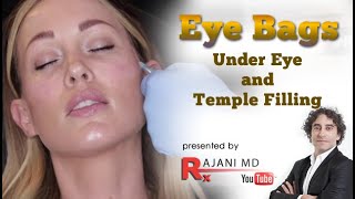 WATCH TEMPLE AND UNDER EYE INJECTIONS  Eye Bags and Wrinkle Treatment [upl. by Hedwiga]