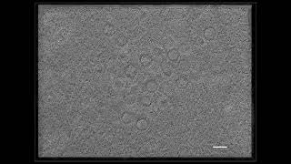 Intranuclear Herpesvirus Capsids Revealed by CryoFIBET [upl. by Mendive]