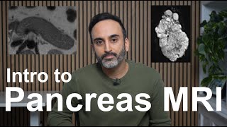 Introduction to Pancreas MRI Approach Pearls CaseBased Course [upl. by Capriola877]