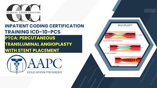 ICD 10 PCS PTCA and STENT [upl. by Nairrad]