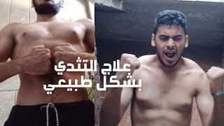 علاج التثدي الجينو بشكل طبيعي و فعال عن تجربة شخصية gynaecomastia [upl. by Frodeen742]