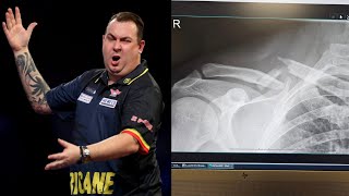 Darts Star Seriously INJURED in Shocking Incident Throwing Arm [upl. by Mei923]