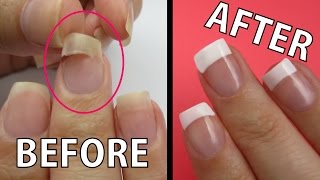 REPAIR A RIPPED NAIL FAST [upl. by Guendolen]