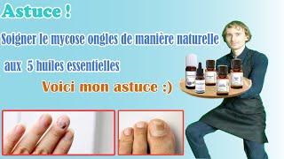 Lhuile essentielle ultime pour des soins complets et durables contre la mycose des ongles [upl. by Llehsor291]