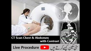 Live CT Scan of Chest  Abdomen with demonstration of Planning and procedure [upl. by Summons962]