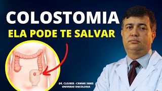 COLOSTOMIA indicações e Cuidados [upl. by Sitoel]